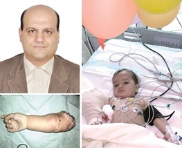 اولین پیوند دست قطع‌شده کودک ۱۳ماهه در ایران و جهان +عکس